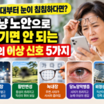 백내장